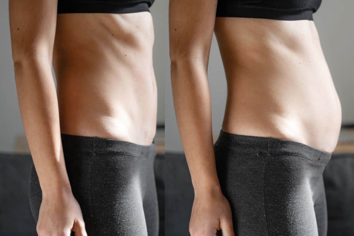 How long does diastasis recti take to improve Wednesbury?
