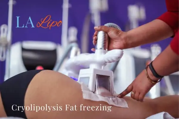 women getting fat freezing Wednesbury